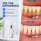 🦷 Portable Ultrasonic Teeth Cleaner ✨ Tartar Stain Remover Kit for Home Oral Care
